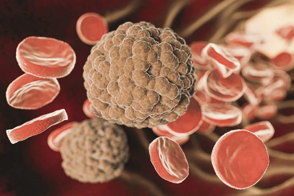 Akut Lenfoblastik Lösemi (ALL) Nedir? Belirtileri ve Tedavi Yöntemleri