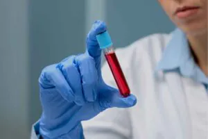 APTT Testi Tedir? aPTT Yüksekliği ve Düşüklüğü