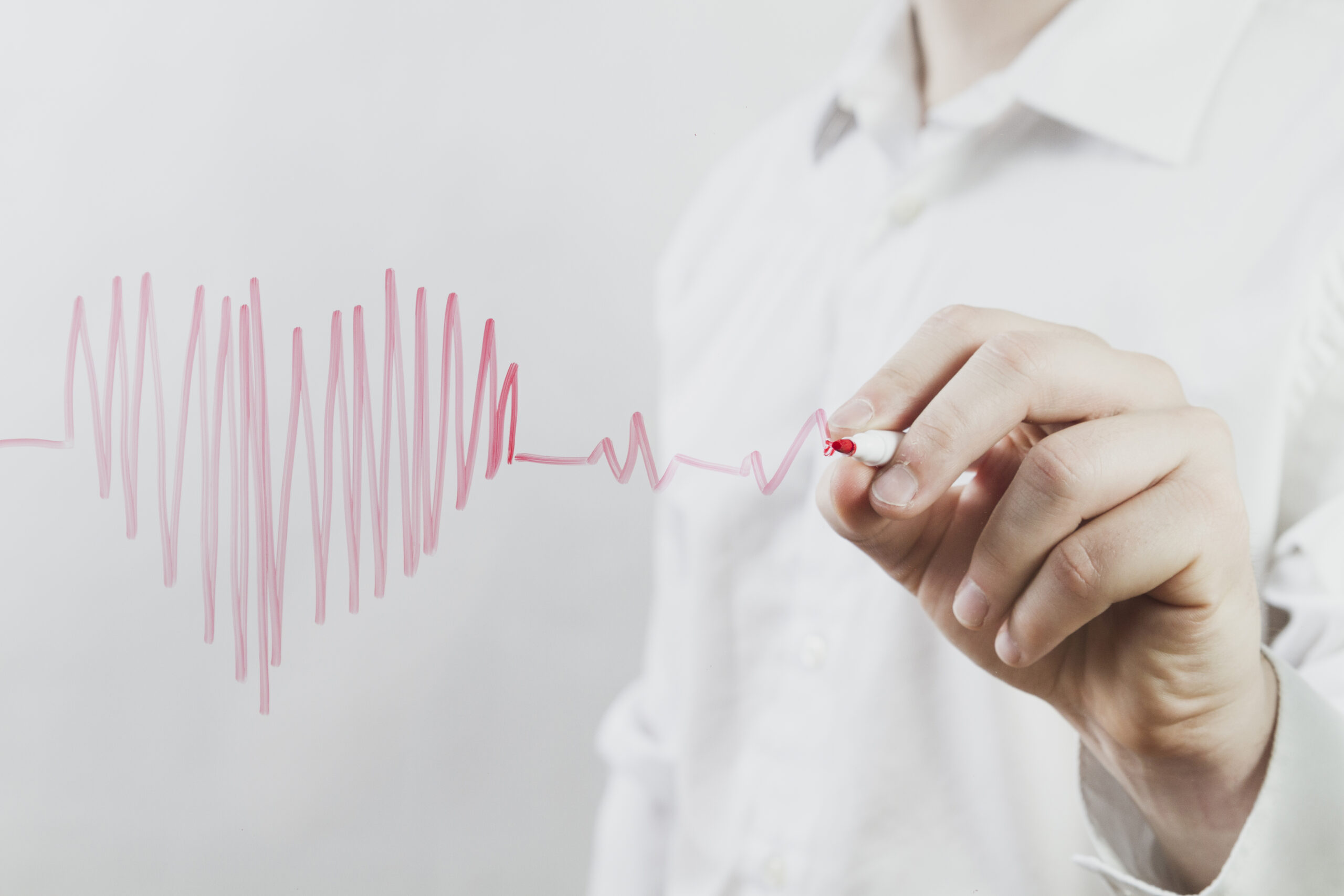 Atriyal Fibrilasyon (AF)