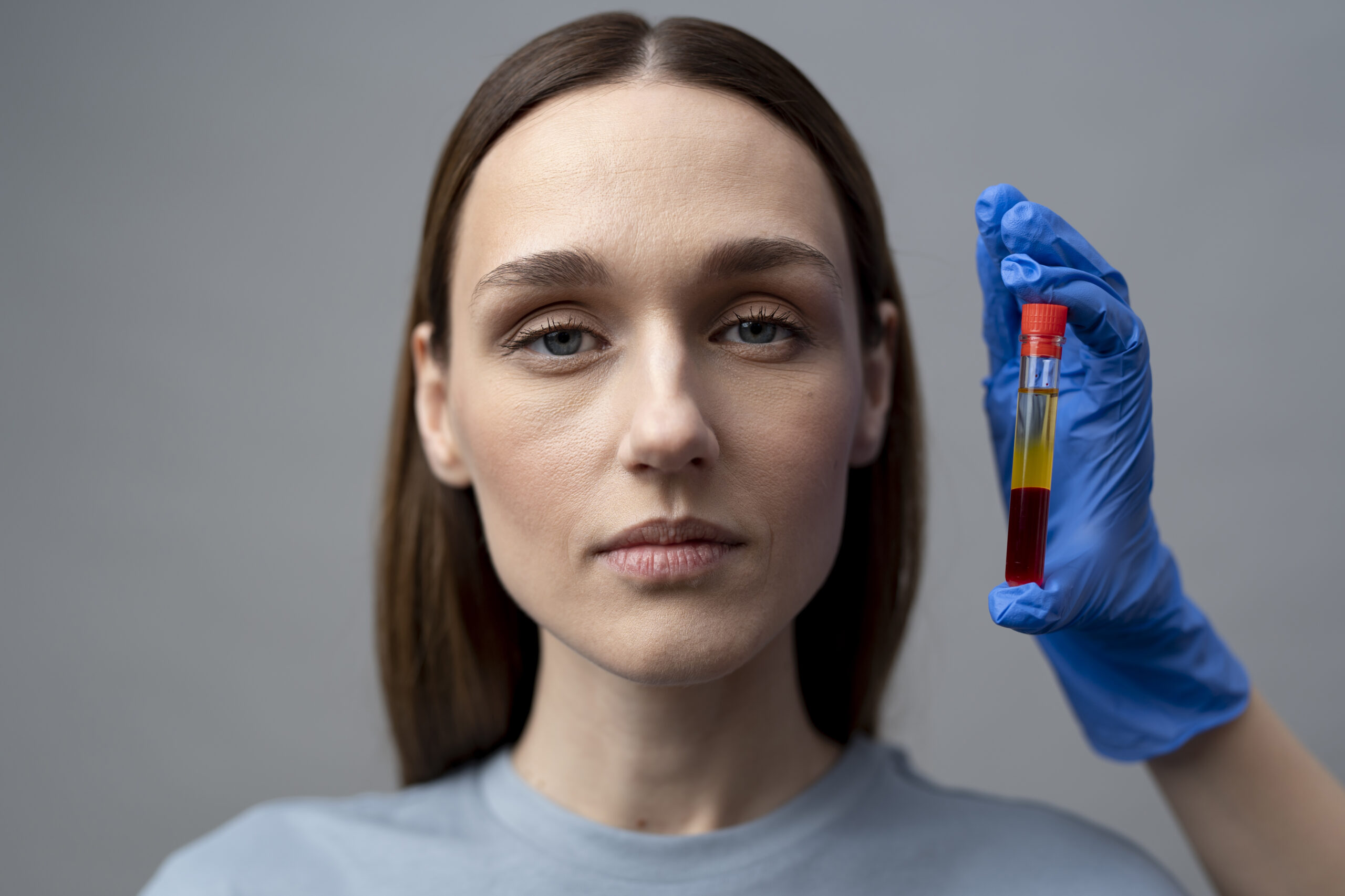 Biyotinidaz Eksikliği