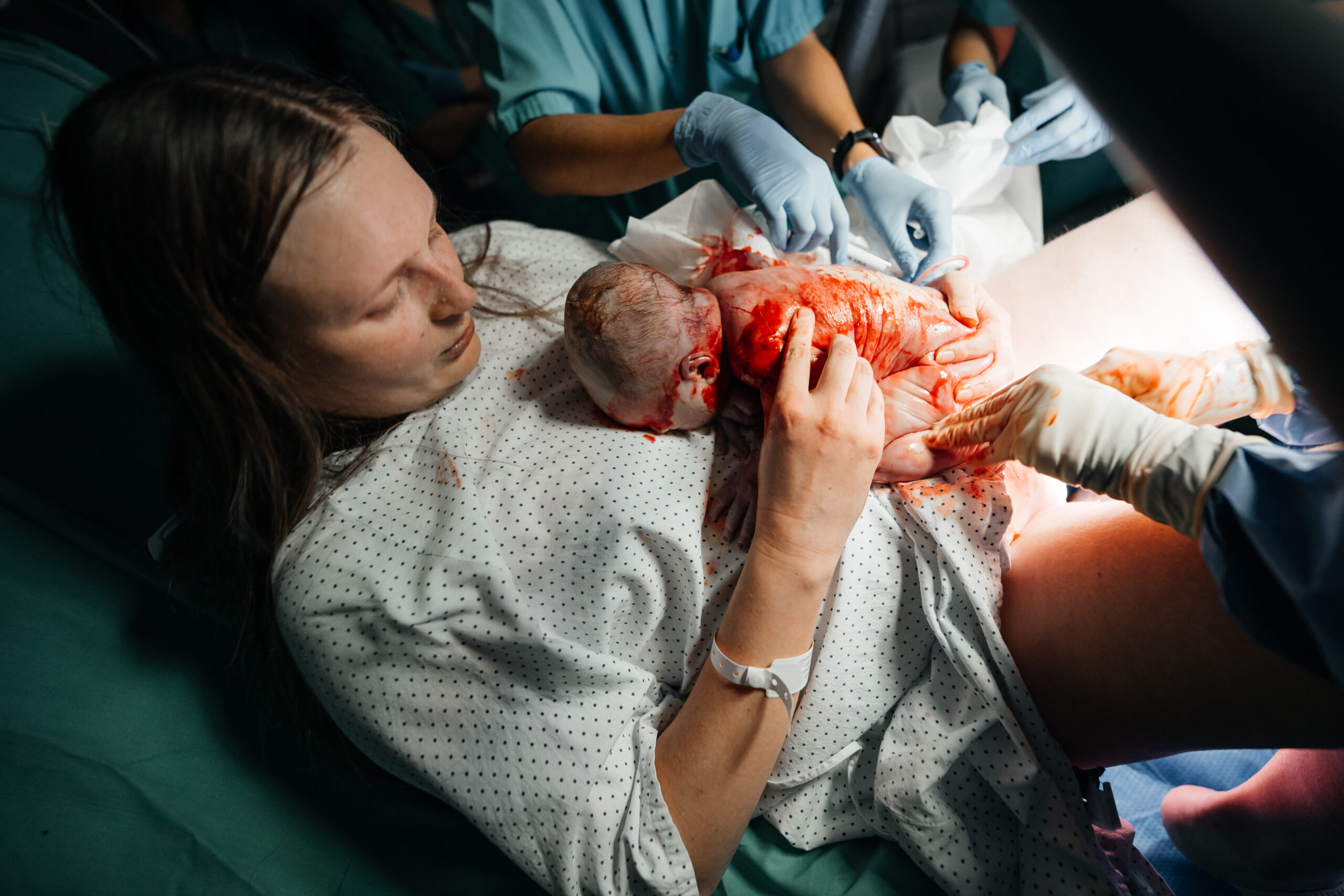 Doğum Sonrası Kanama