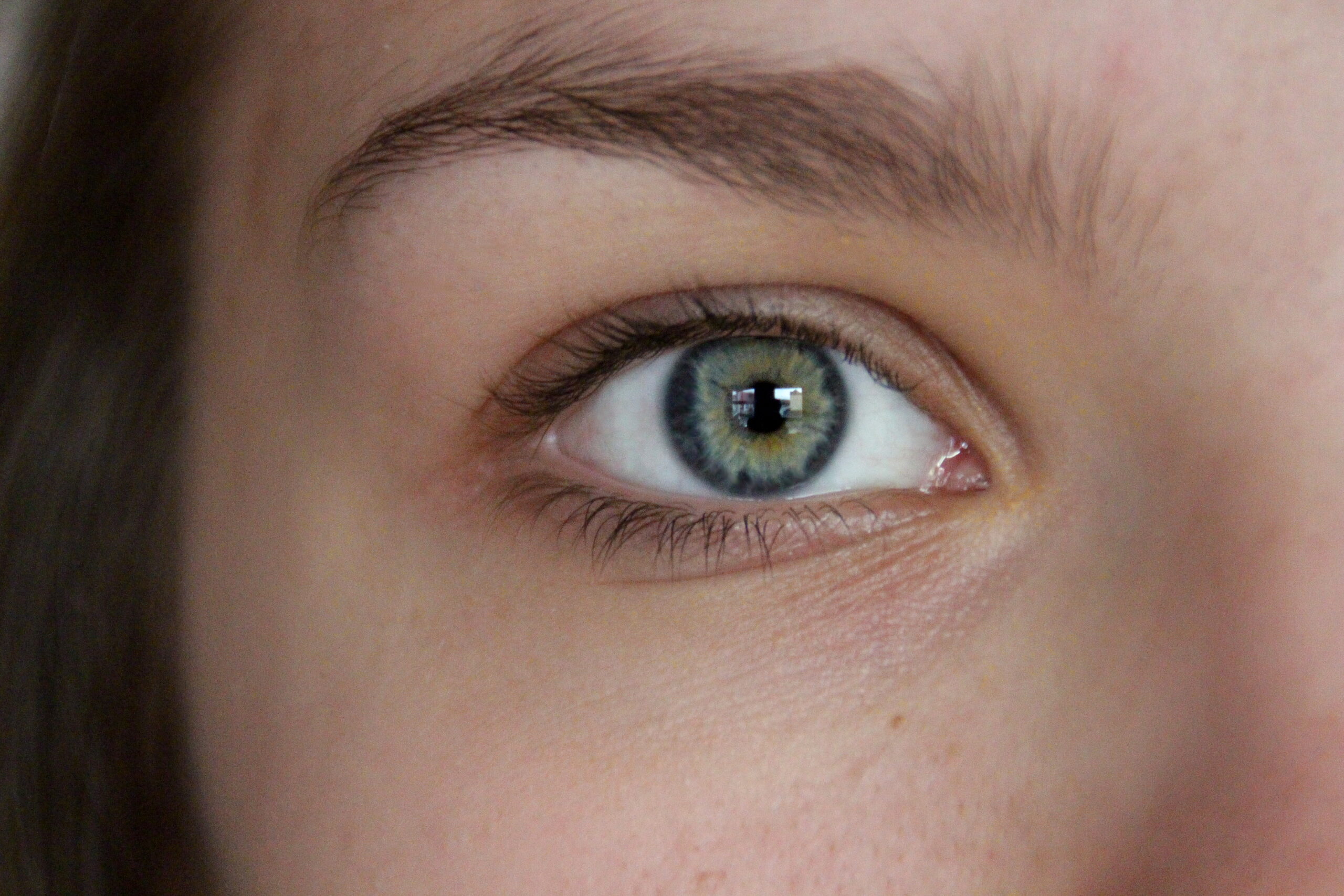 Göz Altı Yağ Bezeleri: Neden Olur ve Nasıl Geçer?