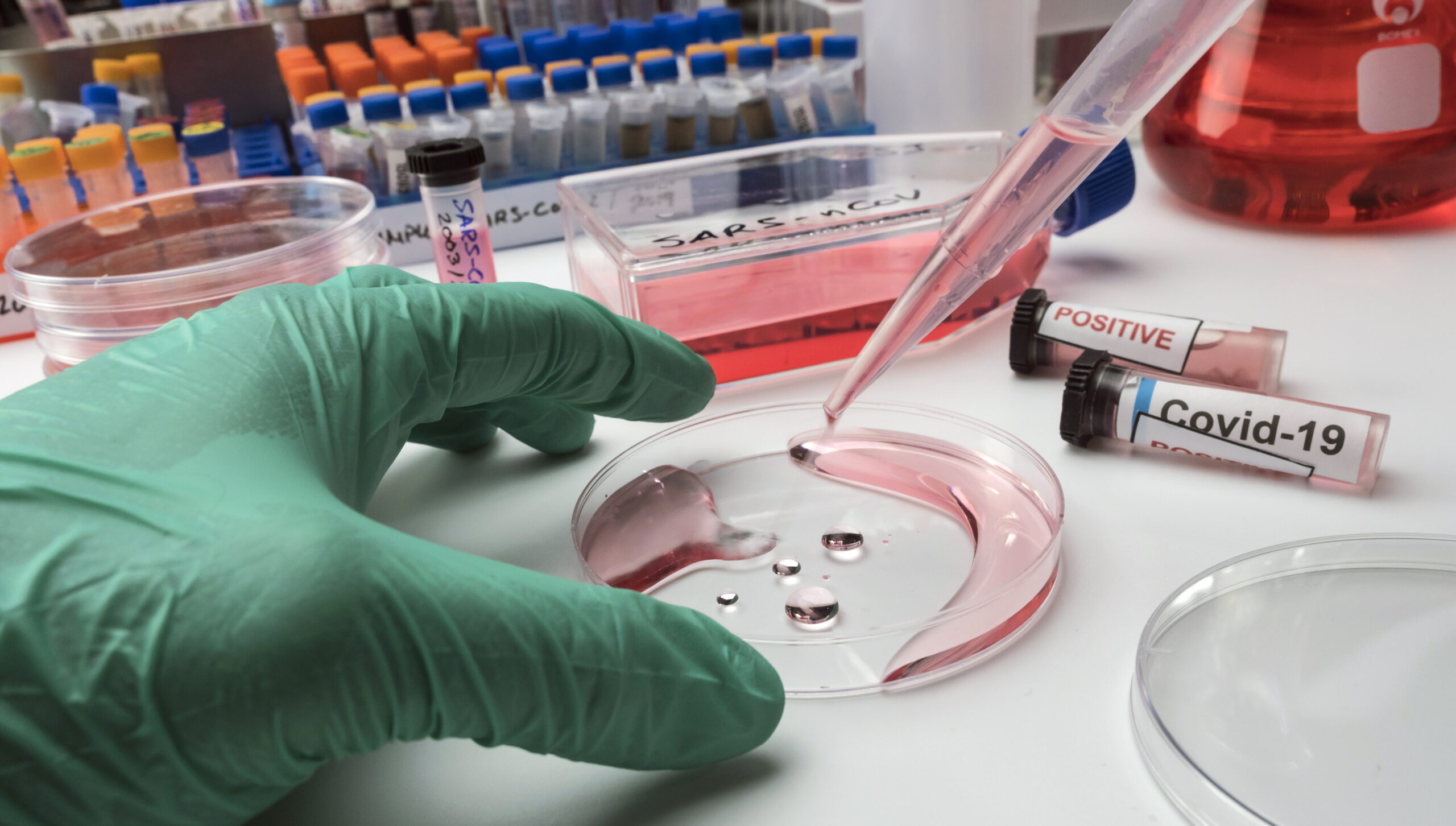 Kök Hücre Tedavisi