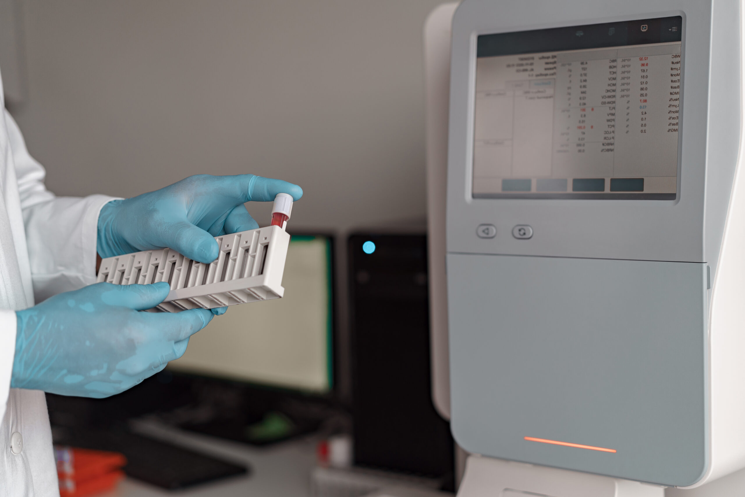 Troponin Nedir? Troponin Seviyelerinin Yüksekliği ve Düşüklüğü