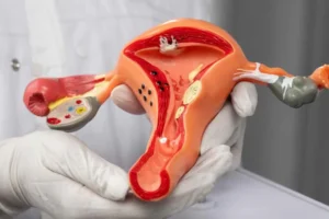 Vajina Daraltma Ameliyatı Nedir?