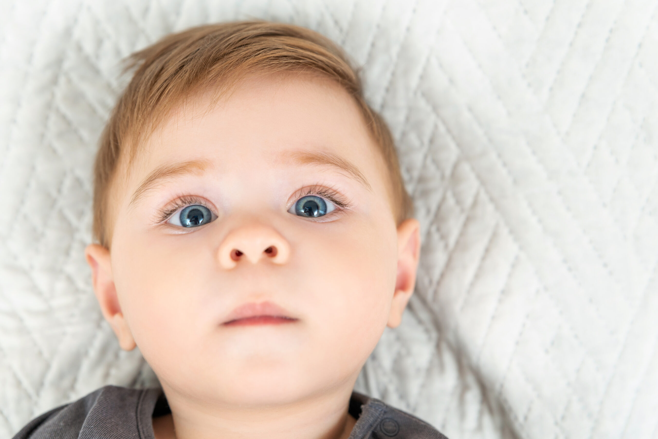 Zellweger Spektrum Nedir? Belirtileri ve Tedavi Seçenekleri